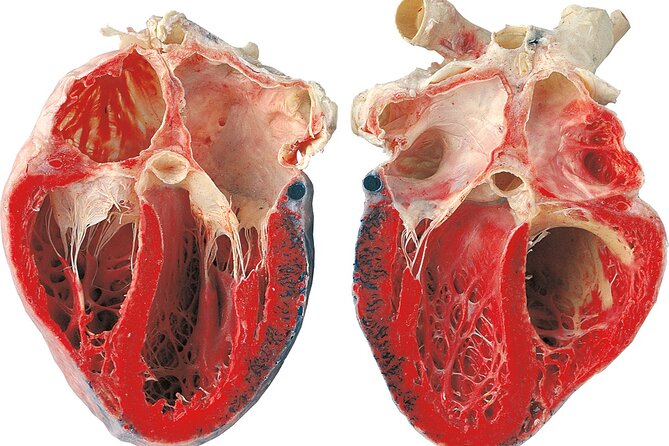 Ticket Expo Body Worlds in Bruges, Belgium - From organs and blood vessels to whole bodies